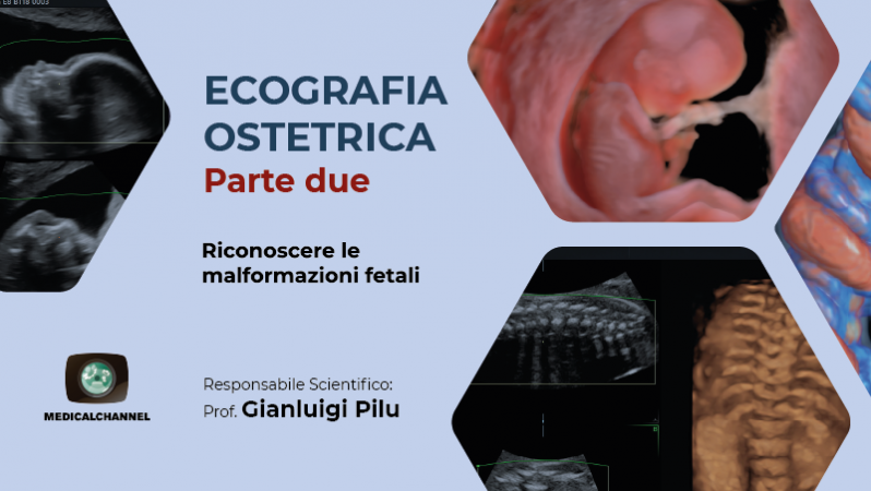 Ecografia ostetrica parte due. Riconoscere le malformazioni fetali